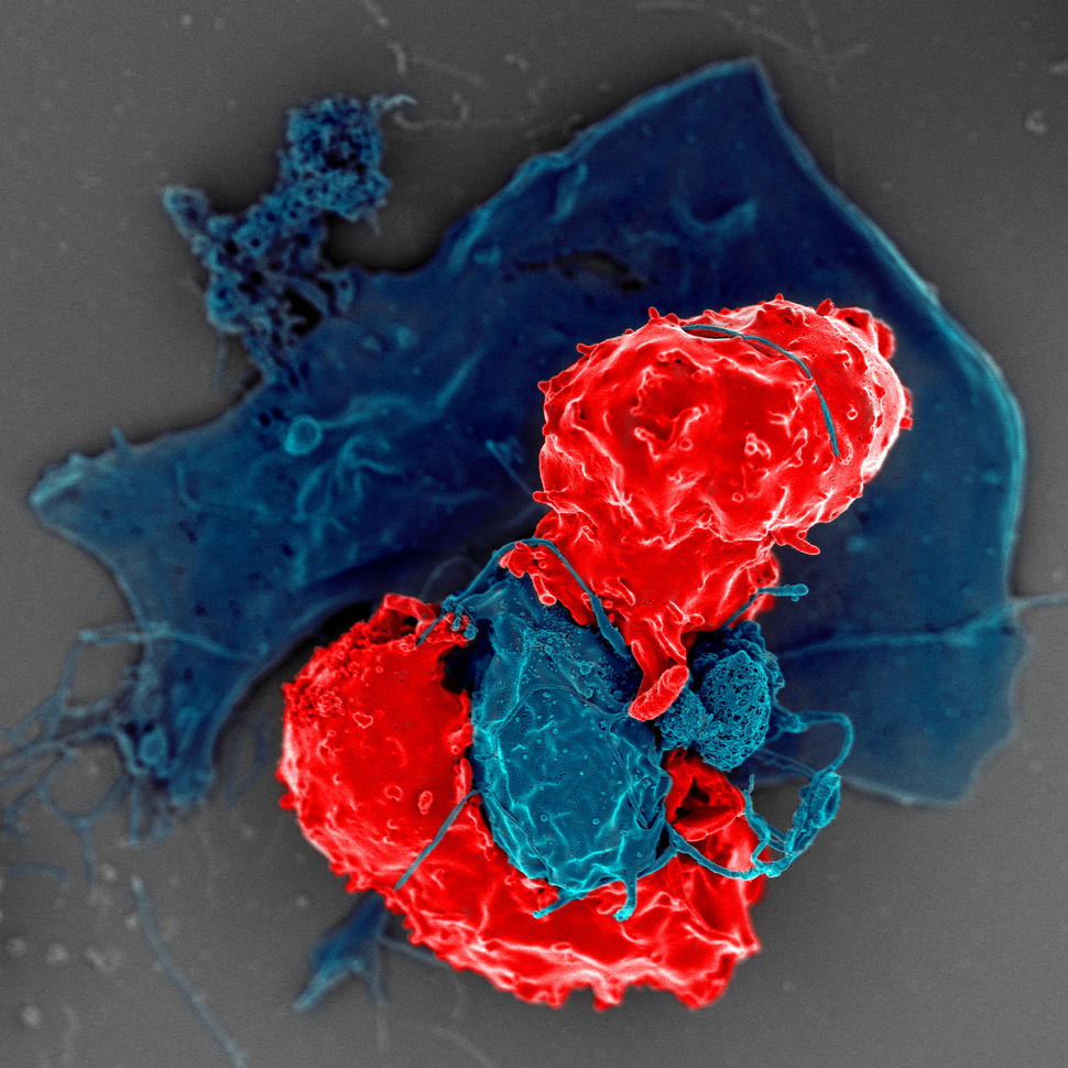 Scanning electron microscope image of T cells interacting with antigen-presenting cells.