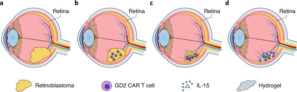 Treatment of retinoblastoma with GD2 CAR T cells