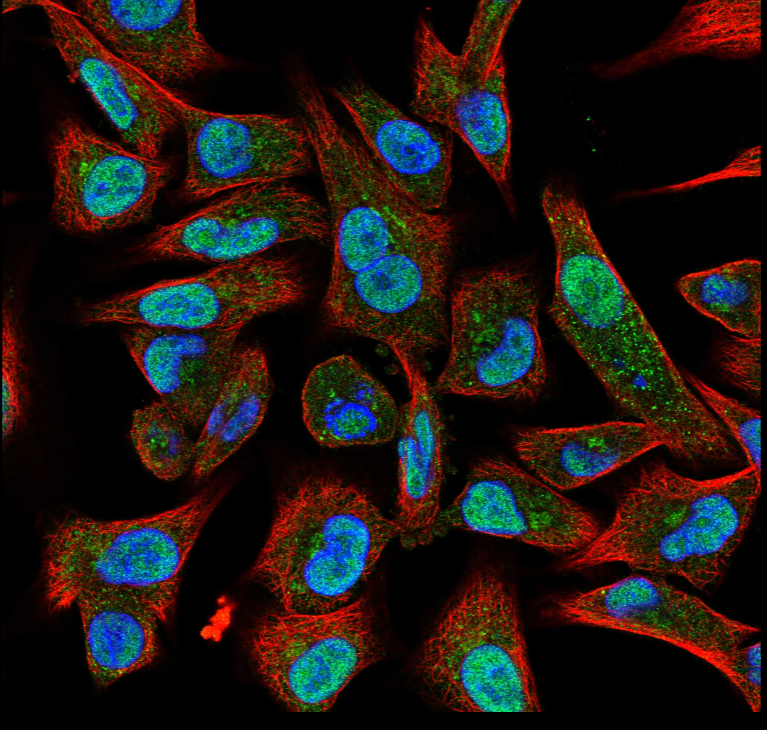 Image of cells with POLQ stained green.