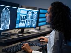 Una radióloga analiza imágenes del cerebro de una resonancia magnética en una pantalla de computadora