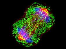 Breast cancer cell dividing, as seen using microscope.