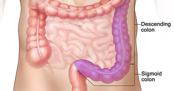 Colorectal Cancer Survival Linked to Tumor Location - National Cancer