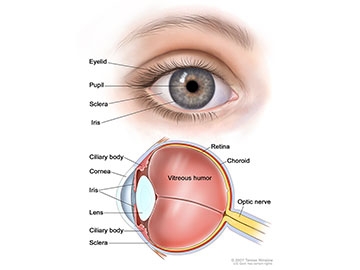 Intraocular (Eye) Melanoma—Patient Version - National Cancer Institute