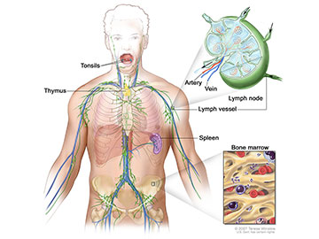 lymphoma skin cell treatment b Version Cancer Lymphomaâ€”Patient Institute National