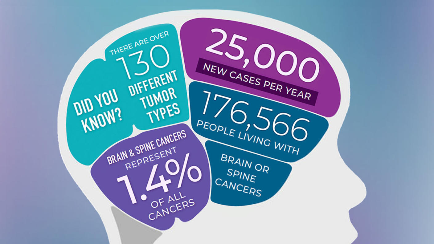 Infographic titled: Did you know? 1. There are over 130 different tumor types. 2. 25,000 new cases per year. 3. 176,566 people living with brain or spine tumors. 4. Brain and spine tumors represent 1.4% of all cancers.