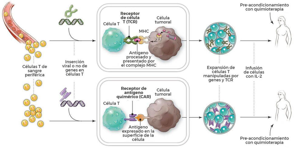 Células T con CAR: manipulación de células inmunitarias para tratar el  cáncer - NCI