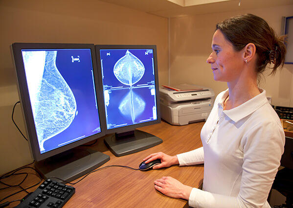 Medical professional reviewing mammography images on computer screen