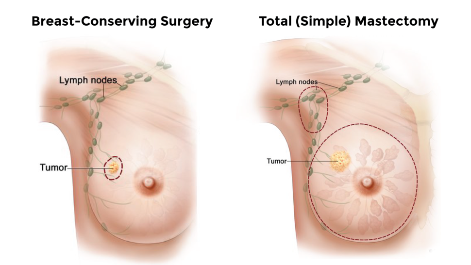 Here's Why Looking at Breasts Can Actually Make You Live Longer