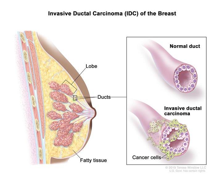 Breast  definition of breast by Medical dictionary