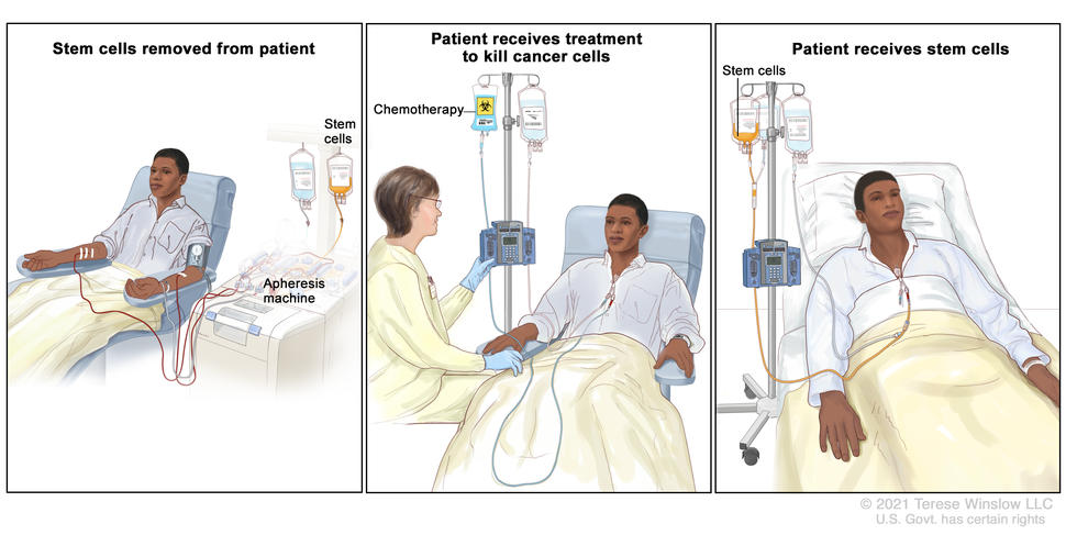 Stem Cell Collection, Infusion, and Transfusion Support: A Primer- Print