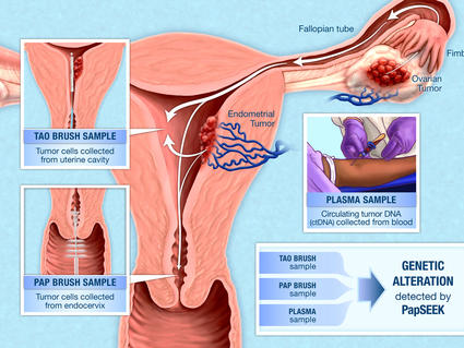 What you should know about bleeding after menopause