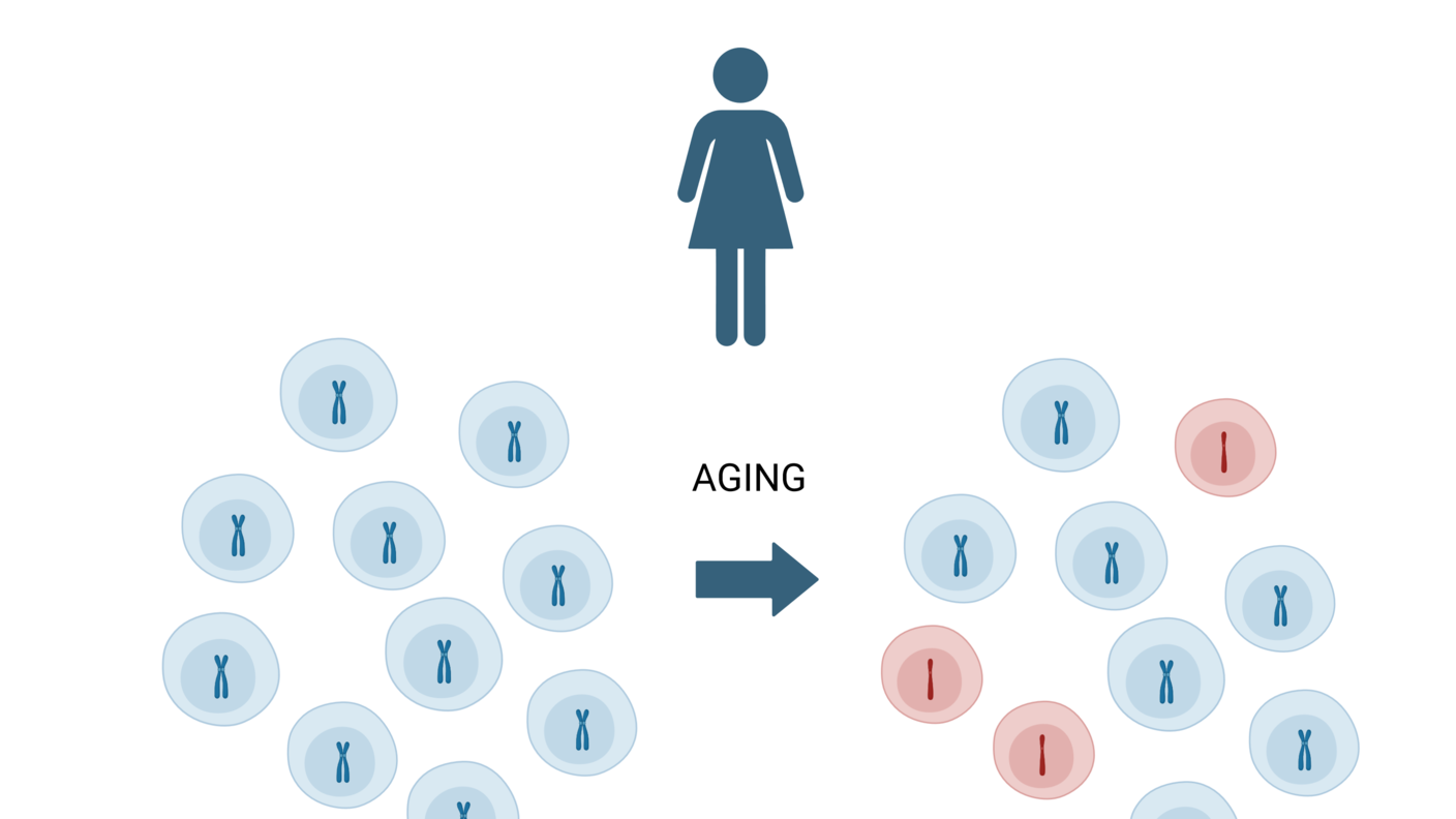 An icon of a female above two sets of 9 cells each with an arrow pointing to the right. Above the arrow is the word aging. The 9 cells to the left of the arrow contain normal X chromosomes. In the 9 cells to the right, three depict a lost copy of the X chromosome. Those abnormal cells are colored red while the normal cells are colored blue. 